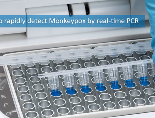 How to rapidly detect Monkeypox by real-time PCR