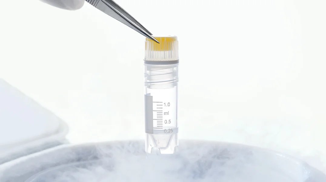 Cell Cryopreservation